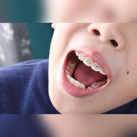 证件矫正拍照软件,让你的证件照不再歪七扭八 证件矫正拍照软件,让你的证件照不再歪七扭八